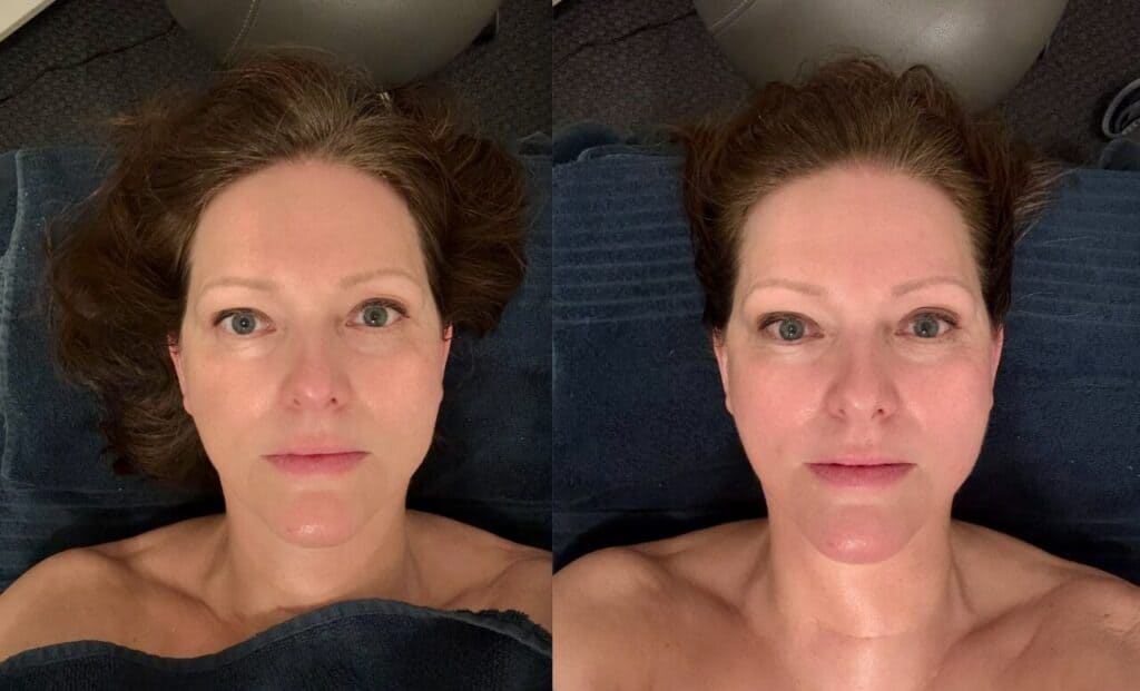 Yin Your Skin facial treatment - 10 år yngre!